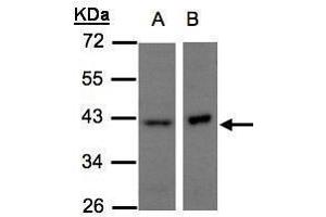 WB Image Sample(30 μg of whole cell lysate) A:H1299 B:Raji, 10% SDS PAGE antibody diluted at 1:500 (NDUFA10 抗体  (Center))
