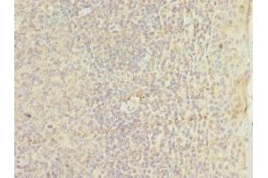 Immunohistochemistry of paraffin-embedded human tonsil tissue using ABIN7172948 at dilution of 1:100 (TM9SF3 抗体  (AA 133-300))