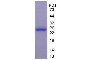 Image no. 1 for Glutathione S-Transferase pi 1 (GSTP1) (AA 1-210) (Active) protein (His tag) (ABIN6239834)