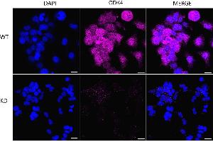 Immunocytochemical staining of HeLa cells using CDK4 antibody (ABIN7798214), 1:1,000), Top panel: wild-type (WT), Bottom panal: CDK4 shRNA knockdown (KD). (Recombinant CDK4 抗体)
