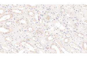 Detection of IL9 in Human Kidney Tissue using Monoclonal Antibody to Interleukin 9 (IL9) (IL-9 抗体  (AA 19-144))