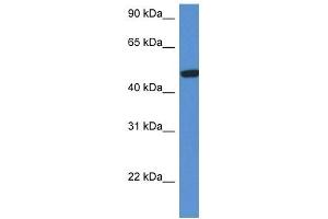 Western Blot showing HEXA antibody used at a concentration of 1 ug/ml against Fetal Kidney Lysate (Hexosaminidase A 抗体  (C-Term))