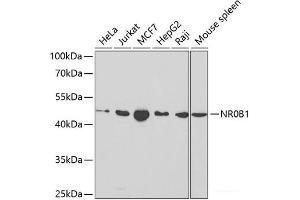 Western blot analysis of extracts of various cell lines using NR0B1 Polyclonal Antibody at dilution of 1:1000. (NR0B1 抗体)