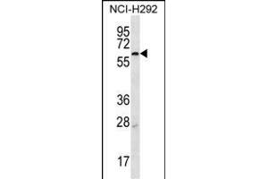MBTPS2 Antibody (N-term) (ABIN656896 and ABIN2846095) western blot analysis in NCI- cell line lysates (35 μg/lane). (MBTPS2 抗体  (N-Term))