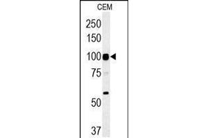 Western blot analysis in CEM cell line lysates (35ug/lane). (ATP6V0A4 抗体  (AA 235-261))