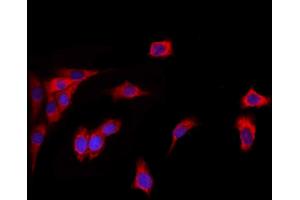 ABIN6260454 and ABIN6272856 staining HepG2 by IF/ICC. (Caprin-1 抗体  (Internal Region))