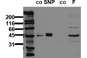 Western Blotting (WB) image for anti-Vasodilator-Stimulated phosphoprotein (VASP) (pSer239) antibody (ABIN126913) (VASP 抗体  (pSer239))