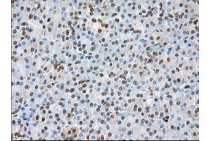 Immunohistochemical staining of paraffin-embedded colon tissue using anti-BSG mouse monoclonal antibody. (CD147 抗体)