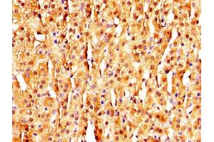 Immunohistochemistry (IHC) image for anti-Melanoma Antigen Family D, 2 (MAGED2) (AA 38-285) antibody (ABIN7159296)
