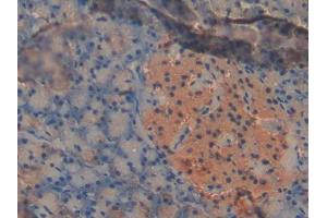 DAB staining on IHC-P; Samples: Mouse Pancreas Tissue (PDK2 抗体  (AA 155-379))