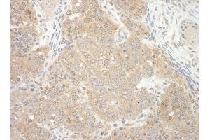Immunohistochemistry (IHC) image for anti-E3 ubiquitin-protein ligase NEDD4-like (NEDD4L) (AA 275-325) antibody (ABIN7448685) (NEDD4-2 抗体  (AA 275-325))