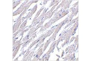 Immunohistochemistry of CRTH2 in human heart tissue with CRTH2 antibody at 2. (Prostaglandin D2 Receptor 2 (PTGDR2) (Center) 抗体)