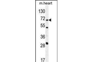 NT5C1B Antibody (N-term) (ABIN654258 and ABIN2844078) western blot analysis in mouse heart tissue lysates (35 μg/lane). (NT5C1B 抗体  (N-Term))