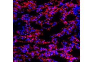 Immunofluorescence (Paraffin-embedded Sections) (IF (p)) image for anti-Mal, T Cell Differentiation Protein 2 (MAL2) antibody (ABIN7074549)