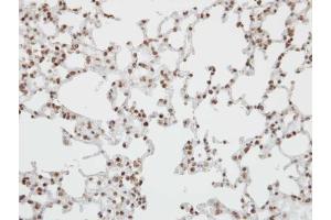 IHC-P Image Immunohistochemical analysis of paraffin-embedded human lung, using Pokemon, antibody at 1:100 dilution. (ZBTB7A 抗体  (C-Term))