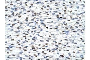 HNRPA0 antibody was used for immunohistochemistry at a concentration of 4-8 ug/ml to stain Myocardial cells (arrows) in Human Heart. (HNRNPA0 抗体  (Middle Region))