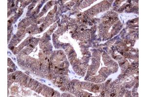 Image no. 1 for anti-Antigen Identified By Monoclonal Antibody Ki-67 (MKI67) (AA 2924-3256) antibody (ABIN1491345) (Ki-67 抗体  (AA 2924-3256))