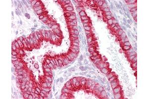 Anti-CHRNB4 antibody IHC of human uterus. (CHRNB4 抗体  (AA 87-101))
