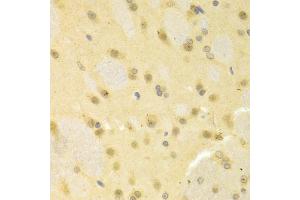 Immunohistochemistry of paraffin-embedded rat brain using SMAD1 antibody (ABIN5970455) at dilution of 1/100 (40x lens). (SMAD1 抗体)