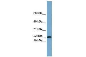 PRR13 antibody used at 1 ug/ml to detect target protein. (Proline Rich 13 抗体  (Middle Region))