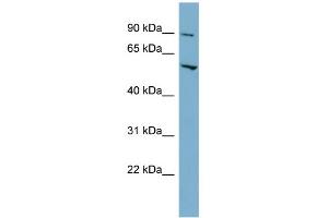 WB Suggested Anti-MFSD1 Antibody Titration:  0.