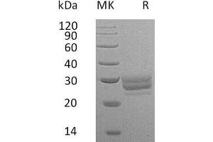 Fms-Related tyrosine Kinase 3 Ligand (FLT3LG) protein (His tag)