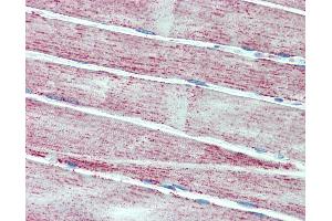 Anti-MNSOD / SOD2 antibody IHC staining of human skeletal muscle.