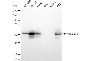 Western blotting analysis using keratin 8 antibody (ABIN7799189).