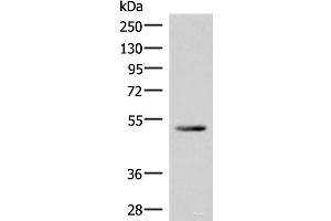 Western blot analysis of Mouse heart tissue lysate using IRX4 Polyclonal Antibody at dilution of 1:400 (IRX4 抗体)