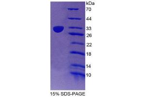 SDS-PAGE (SDS) image for CD1e (CD1e) (AA 39-276) protein (His tag) (ABIN2124371) (CD1e Protein (CD1e) (AA 39-276) (His tag))