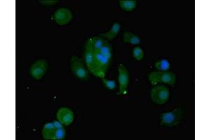 Immunofluorescent analysis of MCF-7 cells using ABIN7175671 at dilution of 1:100 and Alexa Fluor 488-congugated AffiniPure Goat Anti-Rabbit IgG(H+L) (WFDC2 抗体  (AA 31-124))