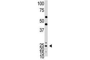 Image no. 1 for anti-Achaete-Scute Complex Homolog 1 (Drosophila) (ASCL1) (C-Term) antibody (ABIN357401) (ASCL1 抗体  (C-Term))