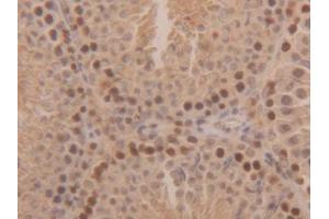 Used in DAB staining on fromalin fixed paraffin-embedded Kidney tissue (SOD1 抗体  (AA 2-154))