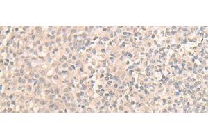 Immunohistochemistry of paraffin-embedded Human tonsil tissue using DDX59 Polyclonal Antibody at dilution of 1:30(x200) (DDX59 抗体)