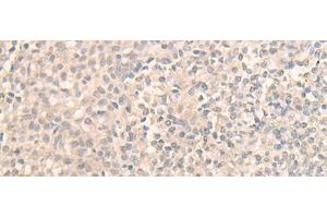 Immunohistochemistry of paraffin-embedded Human tonsil tissue using DDX59 Polyclonal Antibody at dilution of 1:30(x200) (DDX59 抗体)