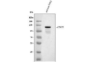 Western blot analysis of VE Cadherin using anti-VE Cadherin antibody (ABIN5692987). (Cadherin 5 抗体  (AA 46-285))