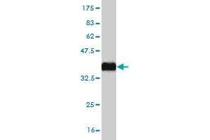 Western Blot detection against Immunogen (37. (ZNF124 抗体  (AA 121-229))