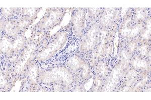 Detection of RNASE2 in Human Kidney Tissue using Polyclonal Antibody to Ribonuclease A2 (RNASE2) (RNASE2 抗体  (AA 28-161))