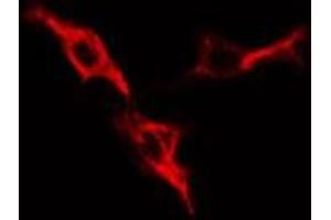 Immunofluorescence (fixed cells) (IF/ICC) image for anti-Protein Kinase, CAMP-Dependent, Regulatory, Type I, alpha (Tissue Specific Extinguisher 1) (PRKAR1A) (N-Term) antibody (ABIN6264423)