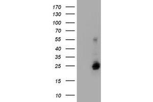 Image no. 2 for anti-Ubiquitin-Conjugating Enzyme E2E 3 (UBE2E3) antibody (ABIN1501622) (UBE2E3 抗体)