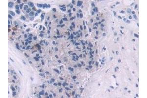 Immunohistochemistry (IHC) image for anti-Interleukin 2 (IL2) (AA 21-153) antibody (ABIN7430795)