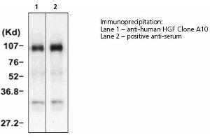 Image no. 1 for anti-Hepatocyte Growth Factor (Hepapoietin A, Scatter Factor) (HGF) antibody (ABIN331456) (HGF 抗体)