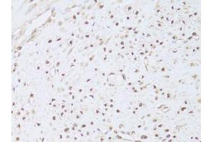 Immunohistochemistry of paraffin-embedded human leiomyoma of uterus using FKBP4 Antibody.