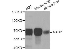 Western blot analysis of extracts of various cell lines, using NAB2 antibody (ABIN5973441) at 1/1000 dilution. (NAB2 抗体)