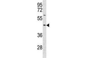 TXNIP antibody western blot analysis in NCI-H292 lysate. (TXNIP 抗体  (AA 1-30))