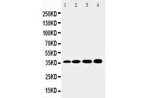 Anti-HSD17B1 antibody, Western blotting Lane 1: Rat Kidney Tissue Lysate Lane 2: Rat Liver Tissue Lysate Lane 3: 293T Cell Lysate Lane 4: HELA Cell Lysate (HSD17B1 抗体  (N-Term))