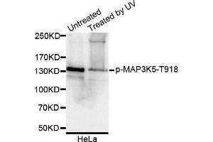 Western Blotting (WB) image for anti-Mitogen-Activated Protein Kinase Kinase Kinase 5 (MAP3K5) (pThr918) antibody (ABIN6225427) (ASK1 抗体  (pThr918))