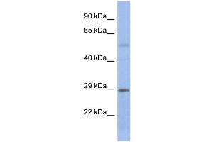 Host:  Rabbit  Target Name:  STEAP1B  Sample Type:  Fetal Small Intestine lysates  Antibody Dilution:  1. (STEAP1B 抗体  (N-Term))