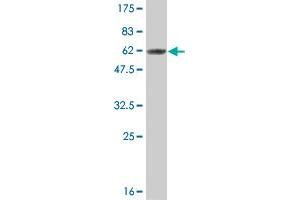 Western Blotting (WB) image for anti-CCR4-NOT Transcription Complex, Subunit 7 (CNOT7) (AA 1-285) antibody (ABIN565426)