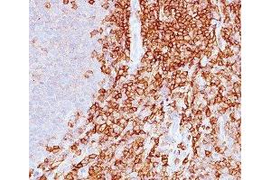 IHC staining of spleen with CD43 antibody (DF-T1). (CD43 抗体)